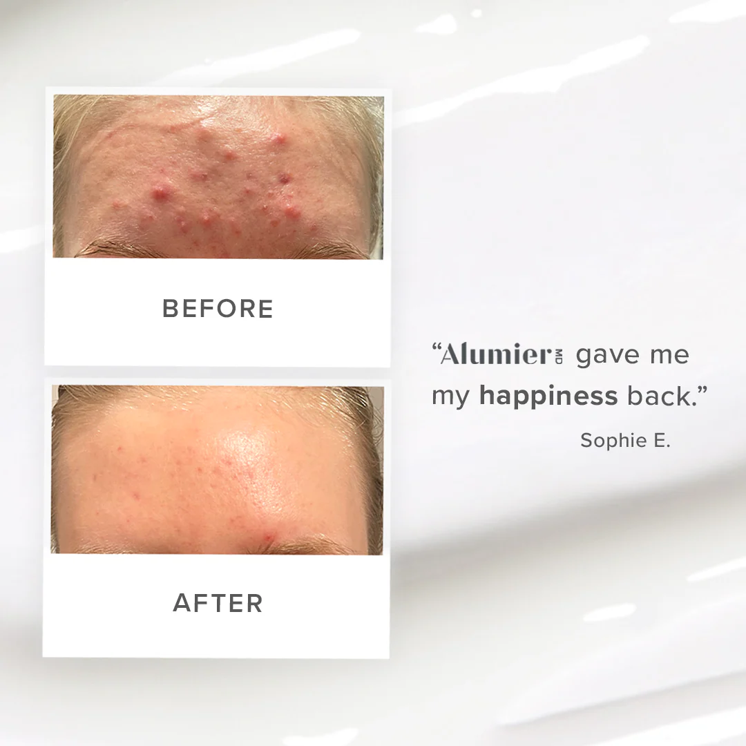 Alumier MD | Clarifying Serum (30ml) - Image 3