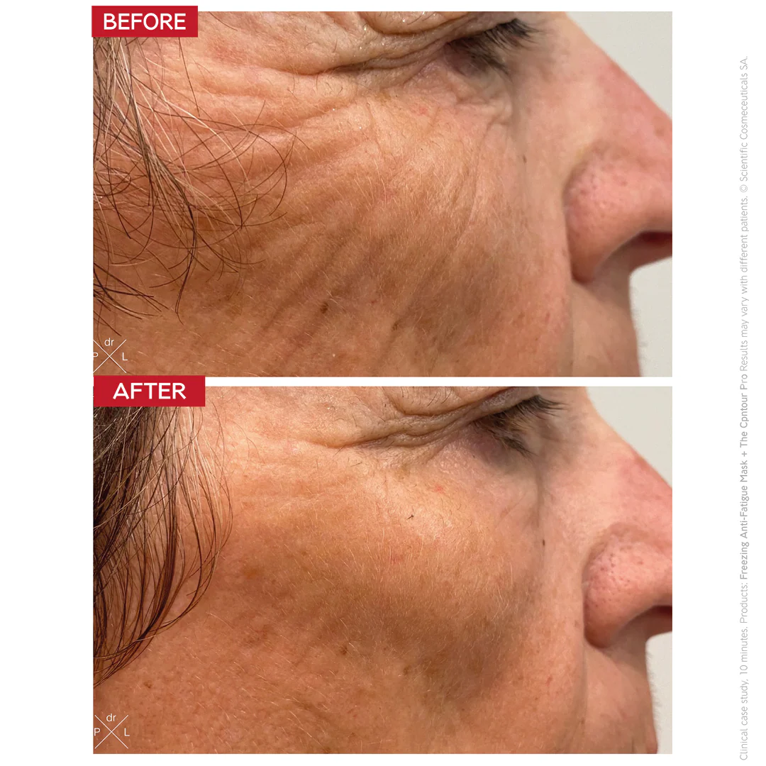 Dr. LEVY | The Contour Pro - Image 4