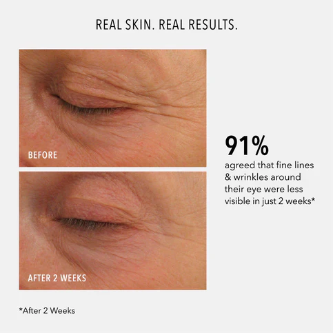 HydroPeptide | Eye Authority: Dark Circles, Puffiness, Fine Lines (15ml) - Image 4