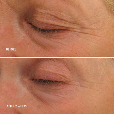 HydroPeptide | Eye Authority: Dark Circles, Puffiness, Fine Lines (15ml) - Image 5