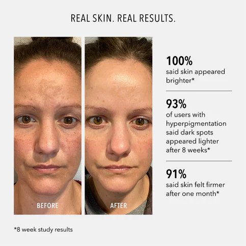 HydroPeptide | Firma Bright Vitamin C Booster (30ml) - Image 4