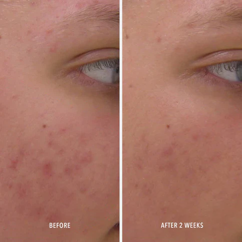 HydroPeptide | Clear Rescue Serum (30ml) - Image 4