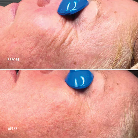 HydroPeptide | Collagen ReActivate PM (30ml) - Image 4