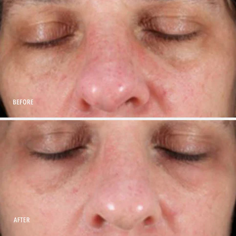 HydroPeptide | Collagen ReActivate PM (30ml) - Image 5