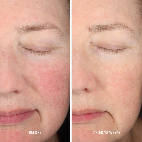 HydroPeptide | InnerDerm RX Kit (30 Capsules) - Image 5