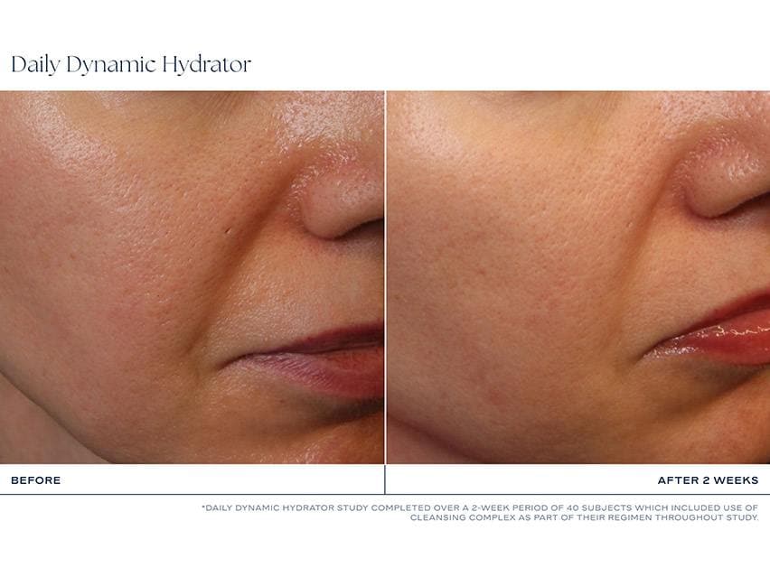 iS Clinical | Daily Dynamic Hydrator (50g) - Image 4