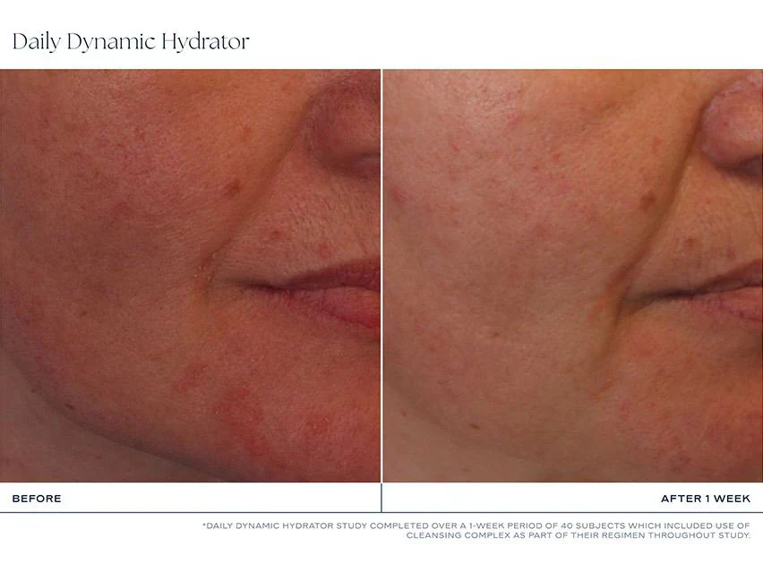 iS Clinical | Daily Dynamic Hydrator (50g) - Image 5