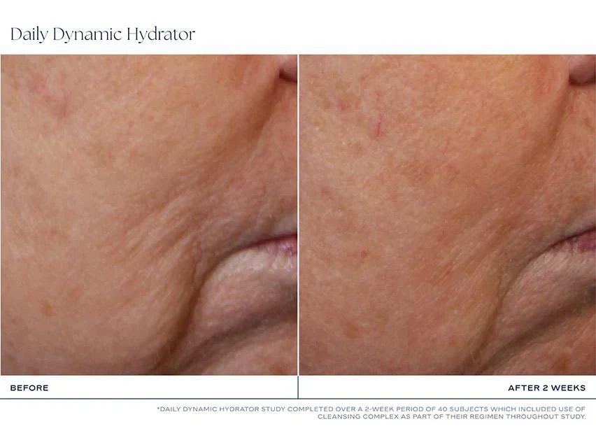 iS Clinical | Daily Dynamic Hydrator (50g) - Image 7