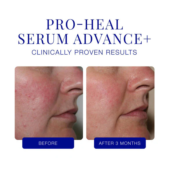 iS Clinical | Pro Heal Serum Advance Plus - Image 3