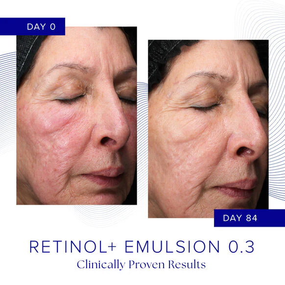 iS Clinical | Retinol + Emulsion 0.3 (30g) - Image 3