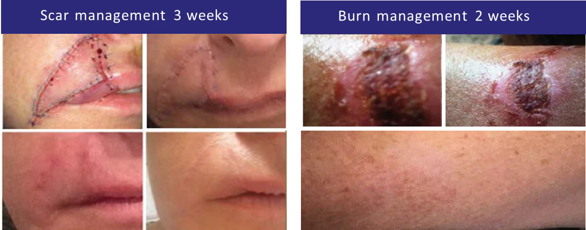iS Clinical | SHEALD Recovery Balm - Image 7