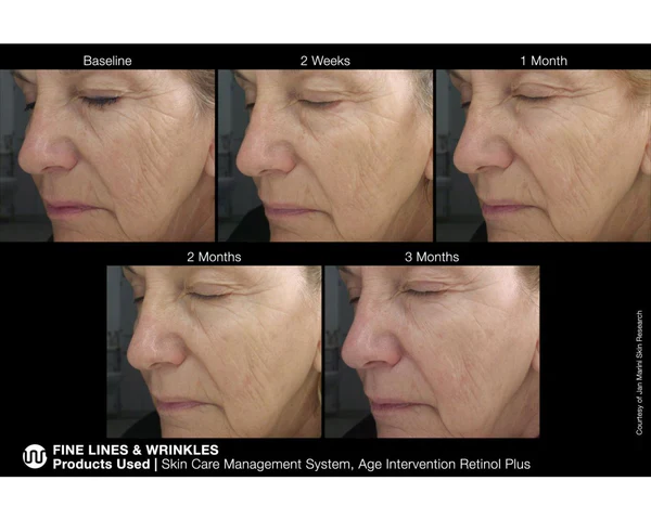 Jan Marini | Age Intervention Retinol Plus (28g) - Image 4