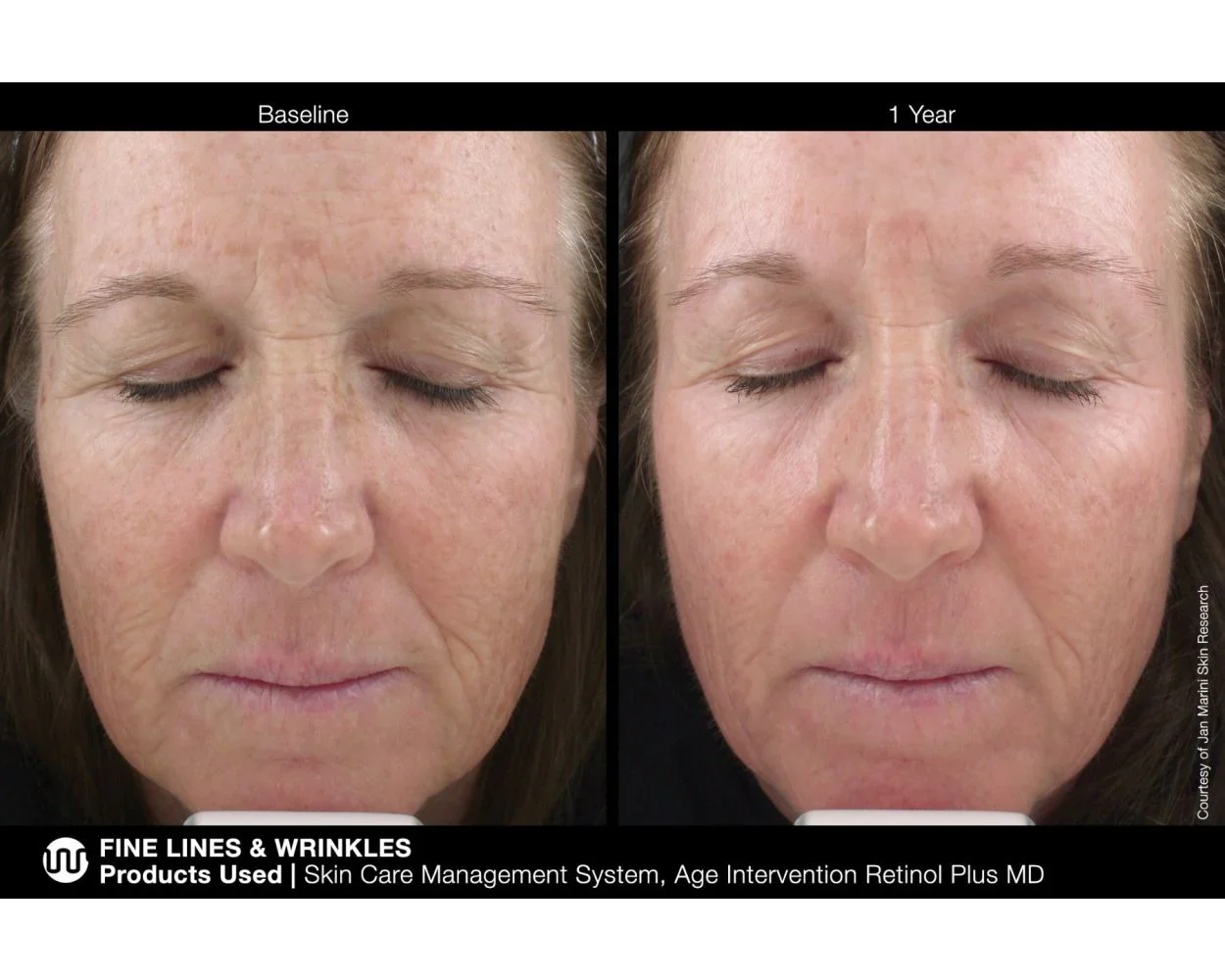 Jan Marini | Age Intervention Retinol Plus MD (28g) - Image 3