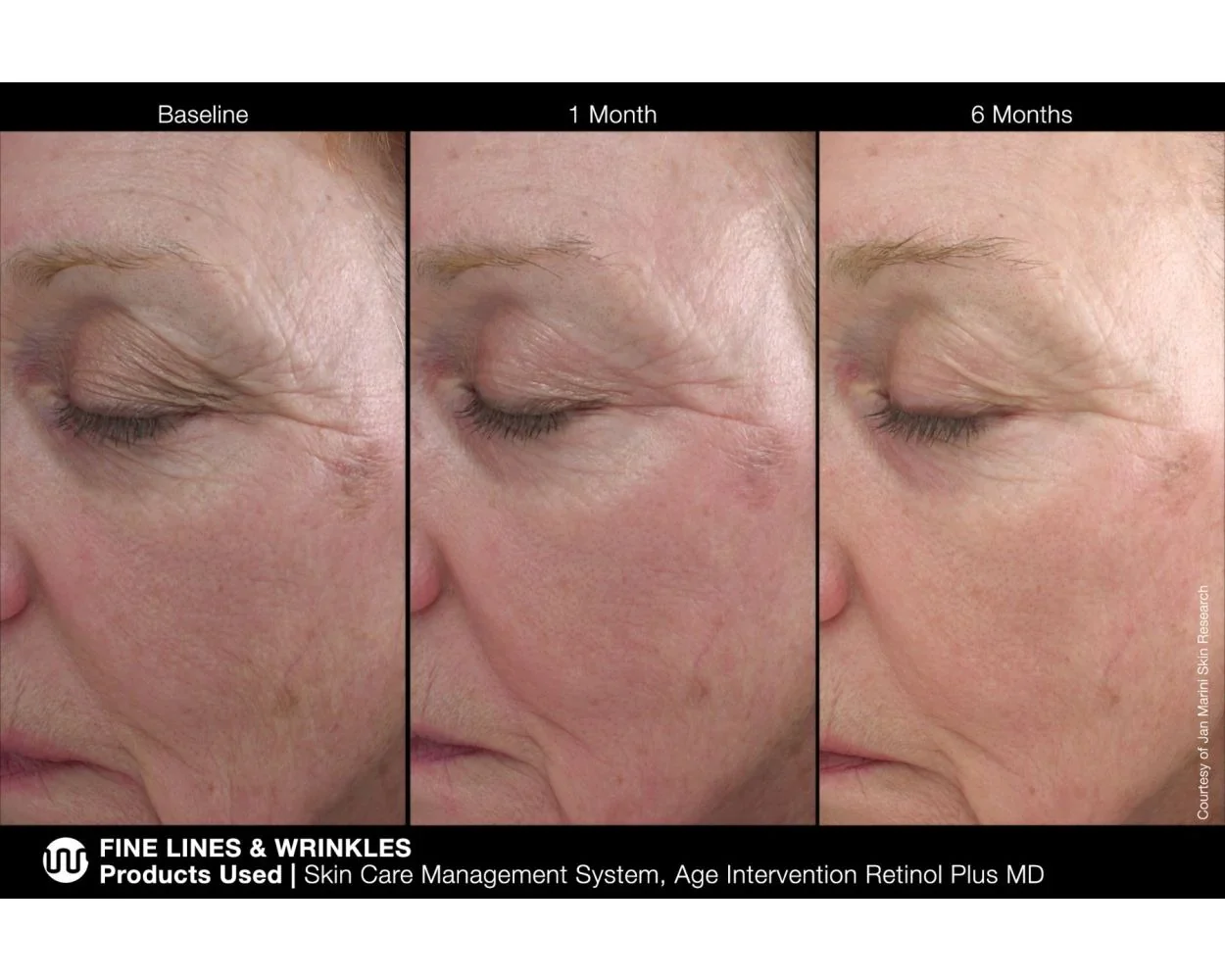Jan Marini | Age Intervention Retinol Plus MD (28g) - Image 4