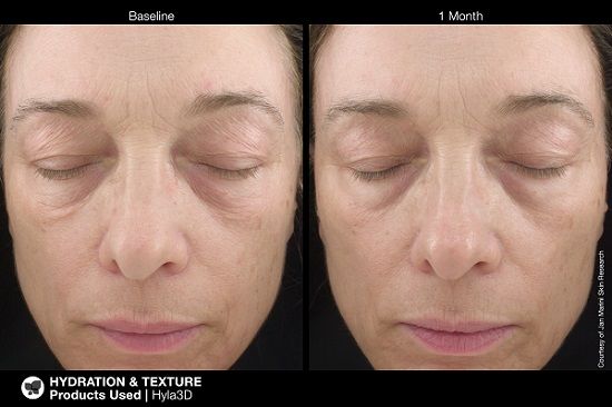 Jan Marini | Hyla3D Face Serum (30ml) - Image 3