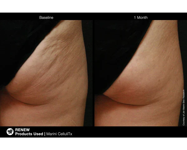 Jan Marini | CelluliTx Cellulite Cream (114g) - Image 4