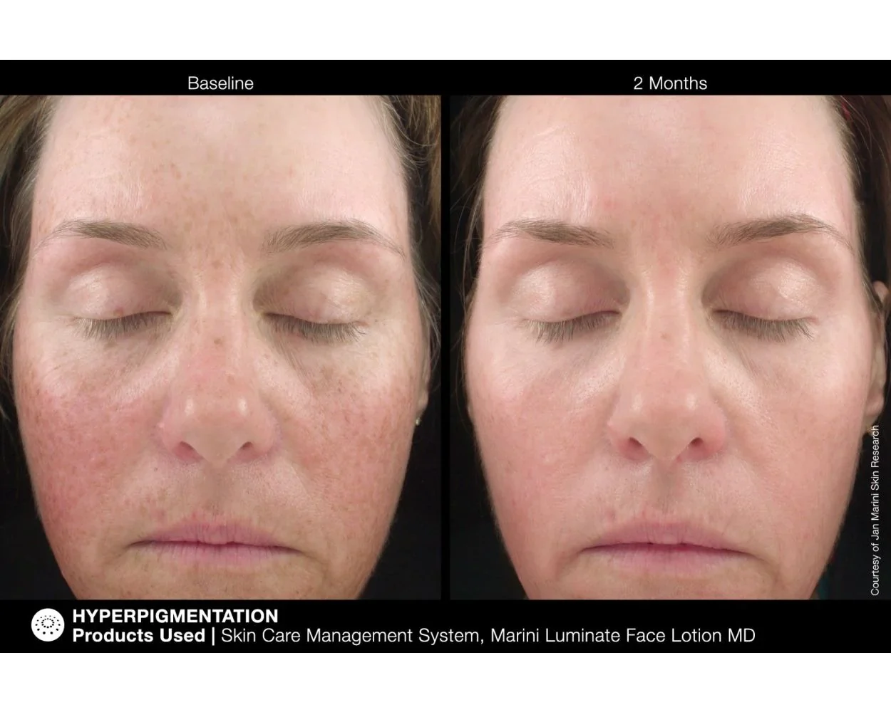 Jan Marini | Luminate Face Lotion MD (30ml) - Image 6