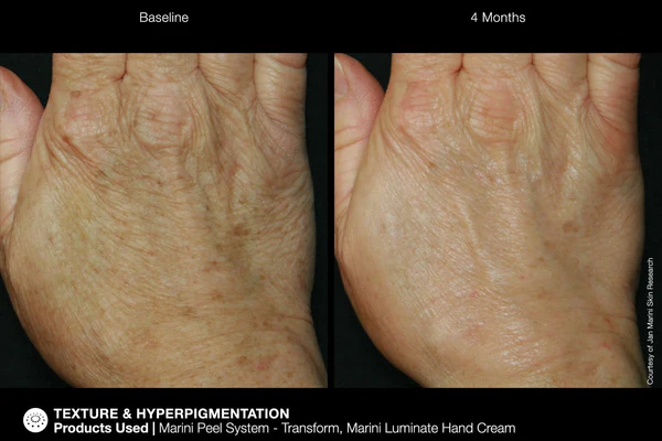 Jan Marini | ReNu Corrective Hand Complex (28g) - Image 4
