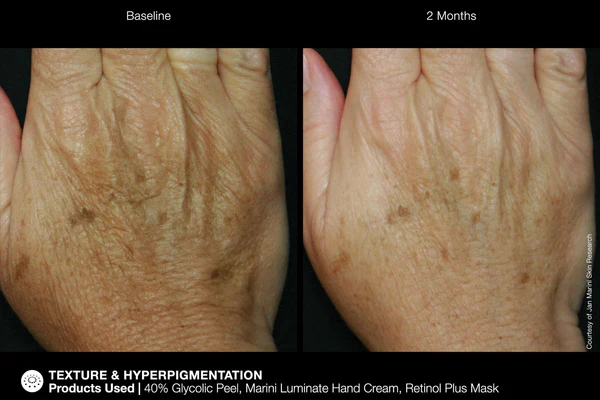 Jan Marini | ReNu Corrective Hand Complex (28g) - Image 5