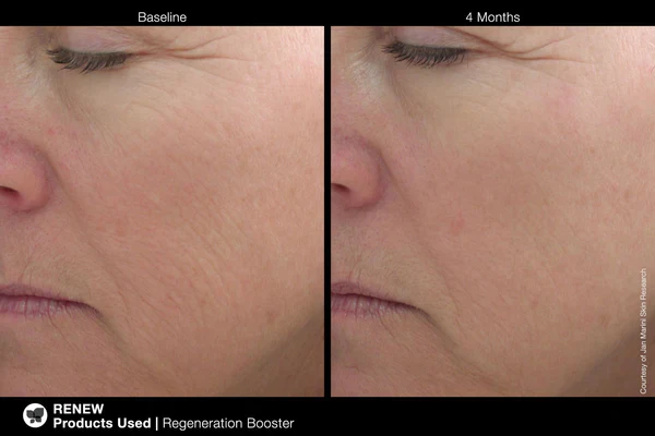 Jan Marini | Regeneration Booster (30ml) - Image 3