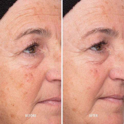 HydroPeptide | Liquid Resurfacing Solution (120ml) - Image 6