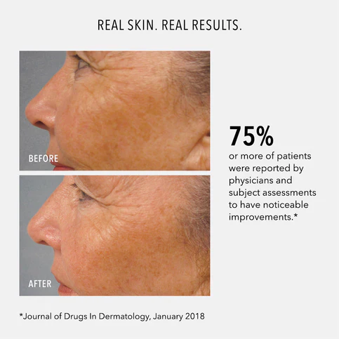 HydroPeptide | LumaPro C : Skin Brightening Pigment Corrector (30ml) - Image 4