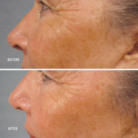 HydroPeptide | LumaPro C : Skin Brightening Pigment Corrector (30ml) - Image 5