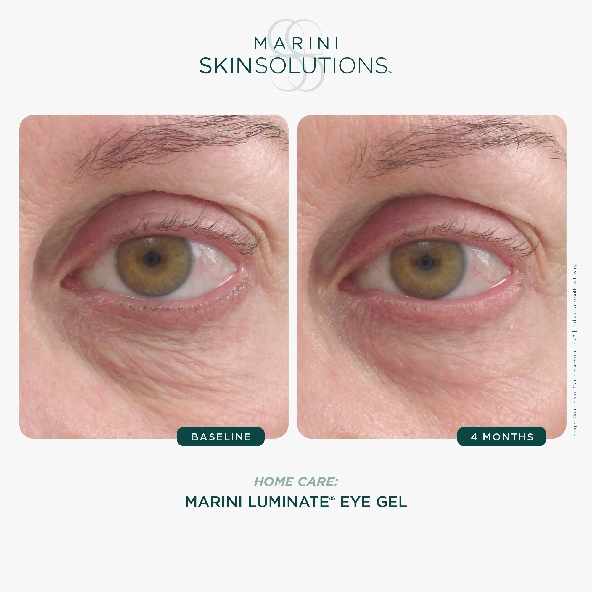 Marini Skin Solutions | Age Intervention Eye Cream (14g) - Image 4