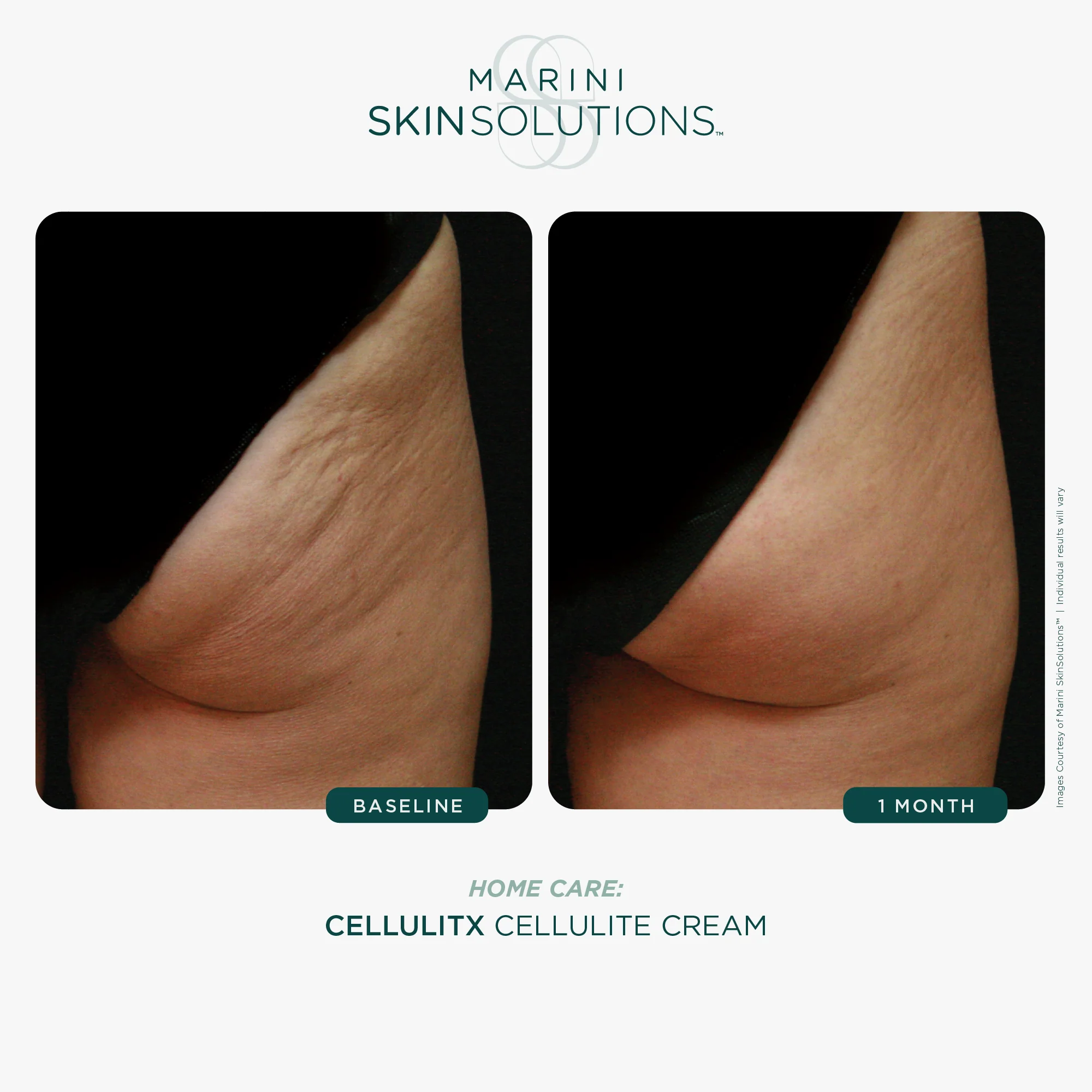 Marini Skin Solutions | CelluliTx (114g) - Image 4