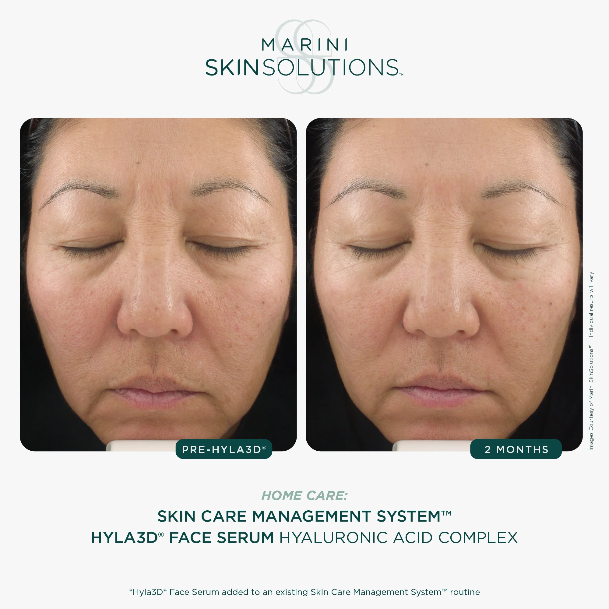 Marini Skin Solutions | Hyla3D Face Serum (30ml) - Image 4