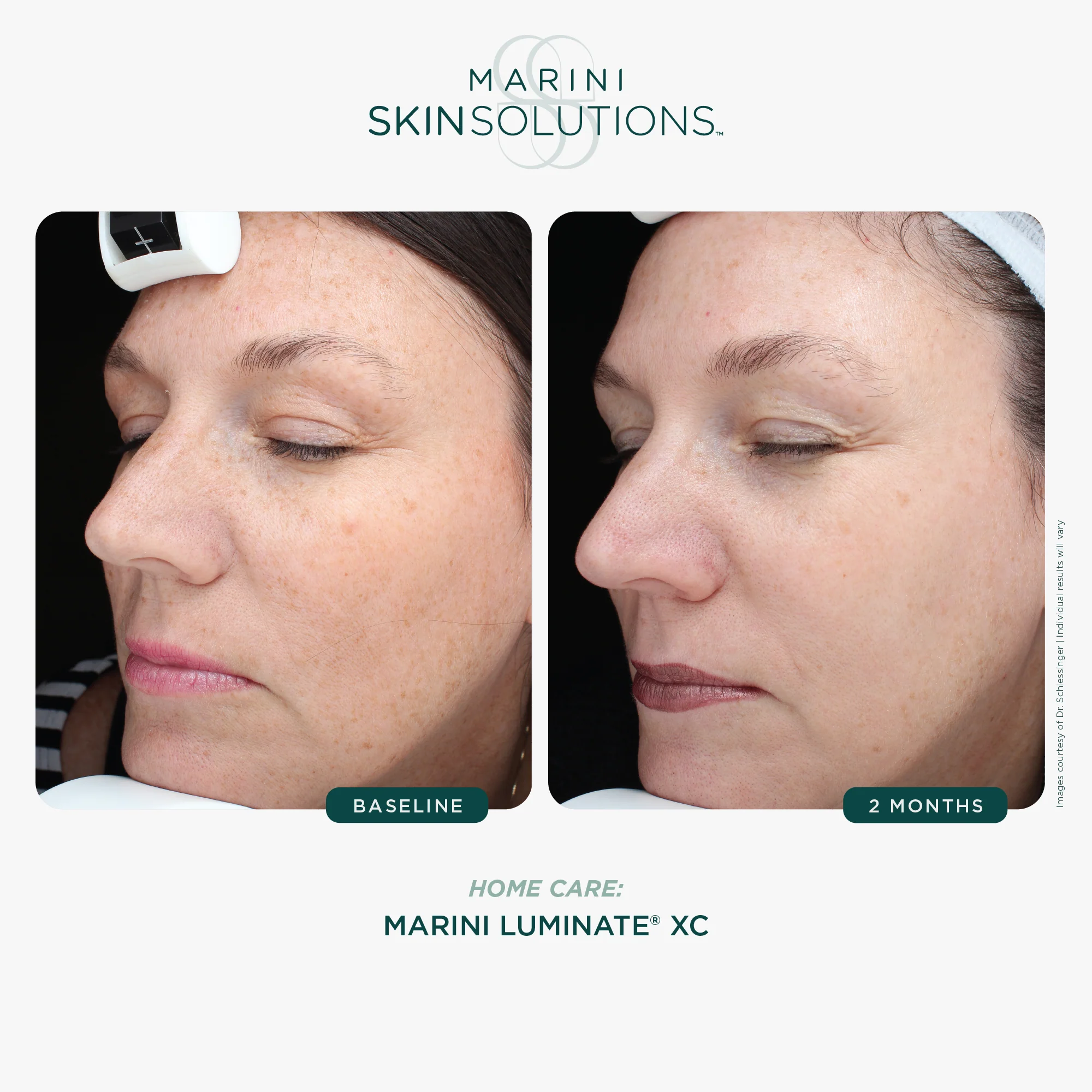Marini Skin Solutions | Luminate XC (30ml) - Image 4