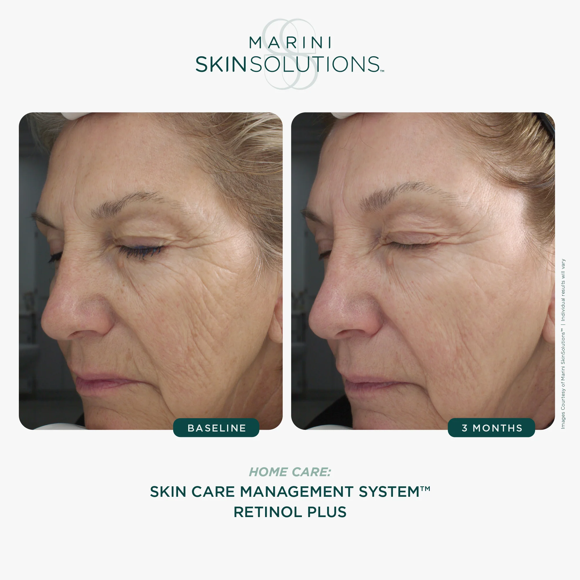 Marini Skin Solutions | Retinol Plus (28g) - Image 4