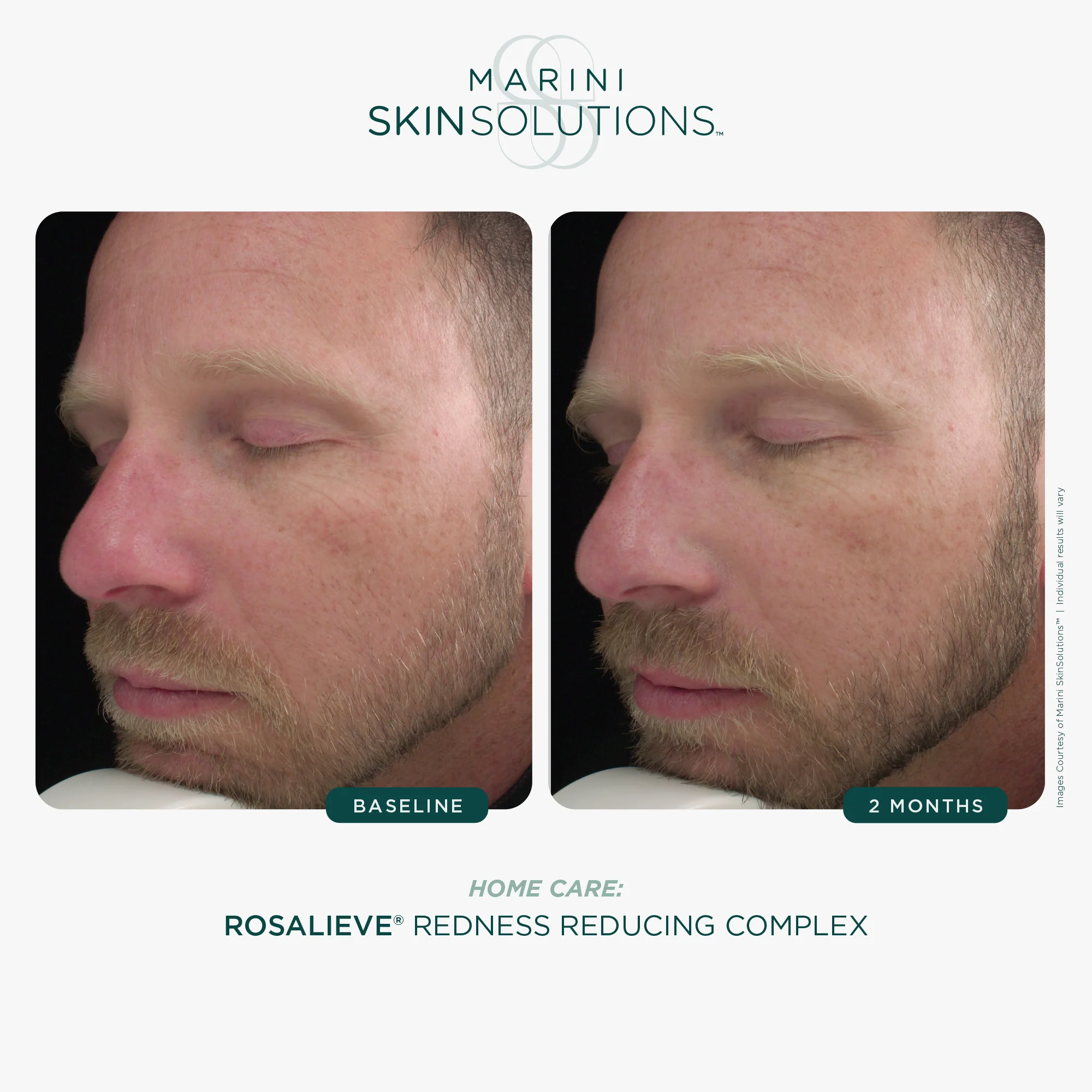 Marini Skin Solutions | RosaLieve (30ml) - Image 7