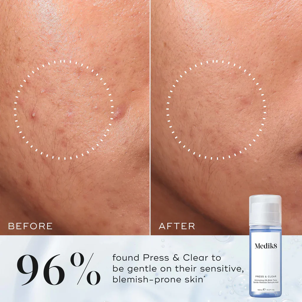 Medik8 | Press and Clear (150ml) - Image 14