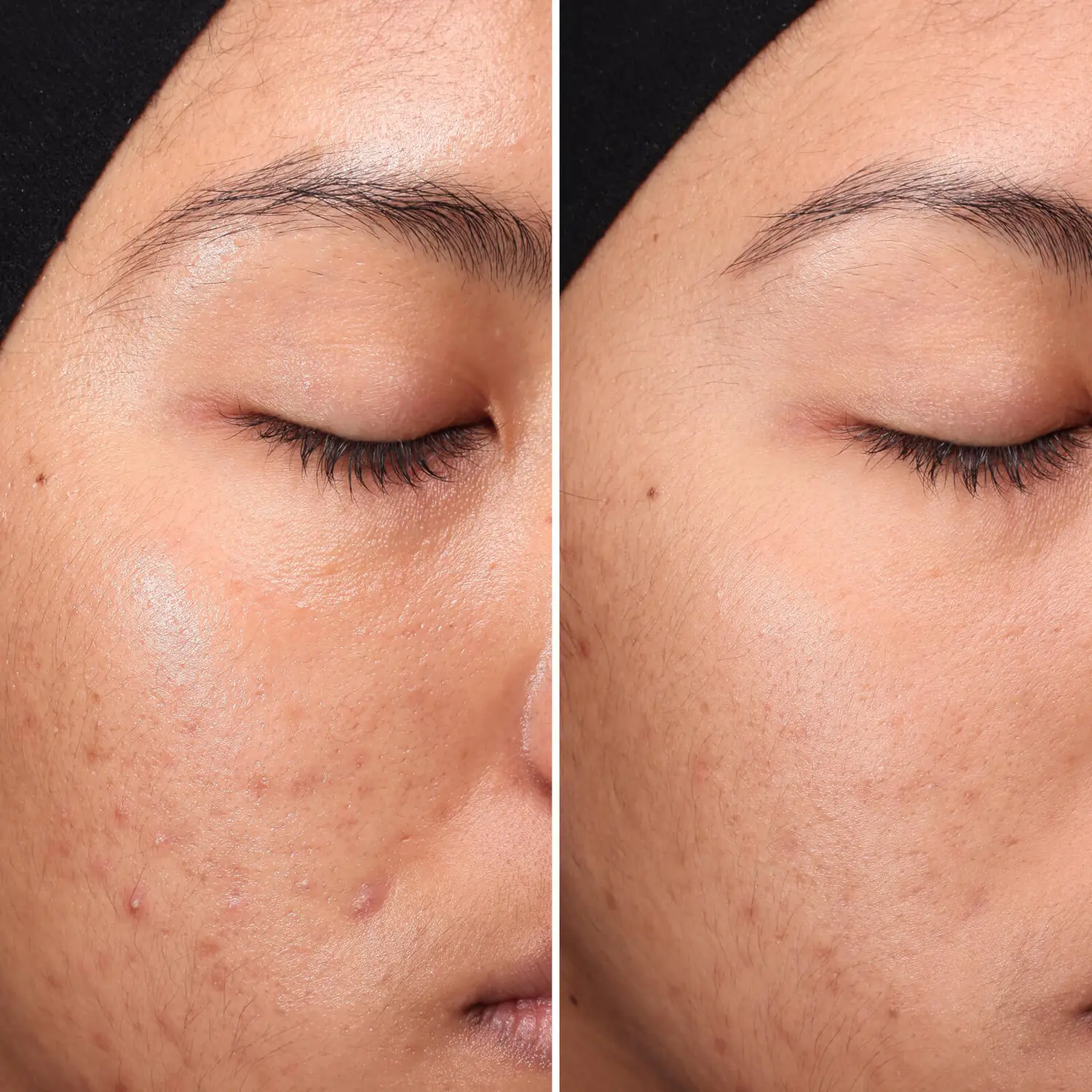 Medik8 | Press and Clear (150ml) - Image 3