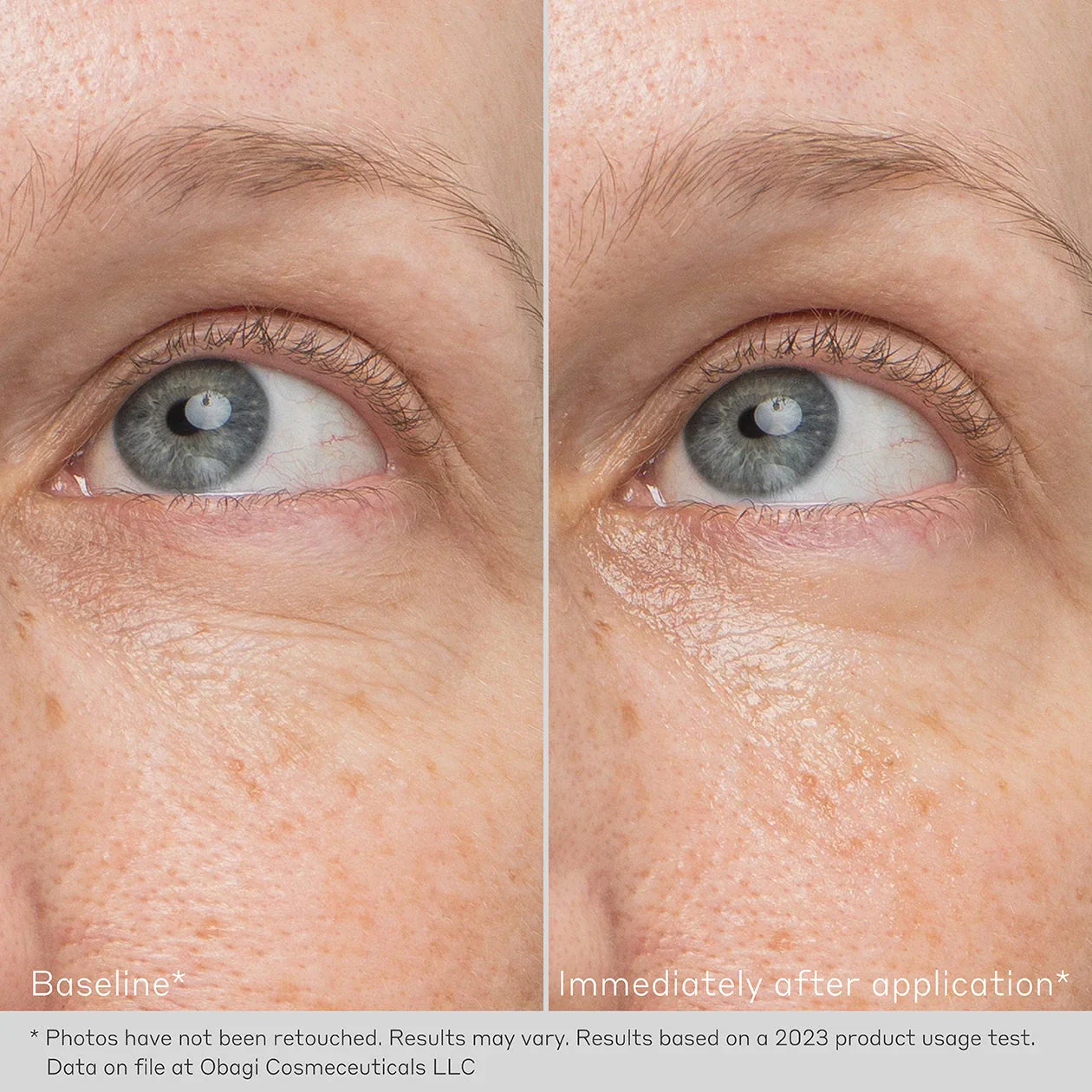 Obagi | Daily Hydro Drops Rejuvenating Eye Gel Cream (15ml) - Image 4