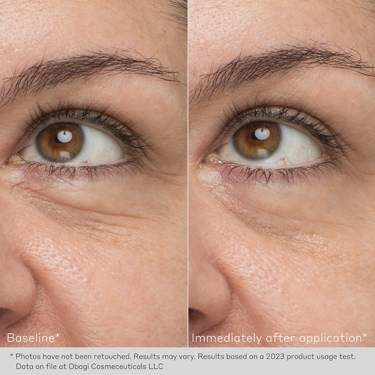 Obagi | Daily Hydro Drops Rejuvenating Eye Gel Cream (15ml) - Image 5