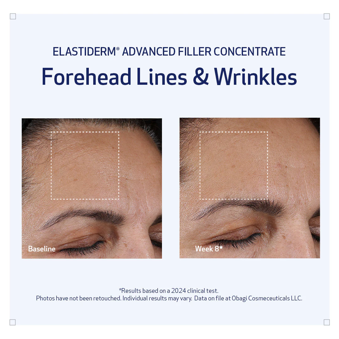 Obagi | ELASTIderm Advanced Filler Concentrate (20ml) - Image 9