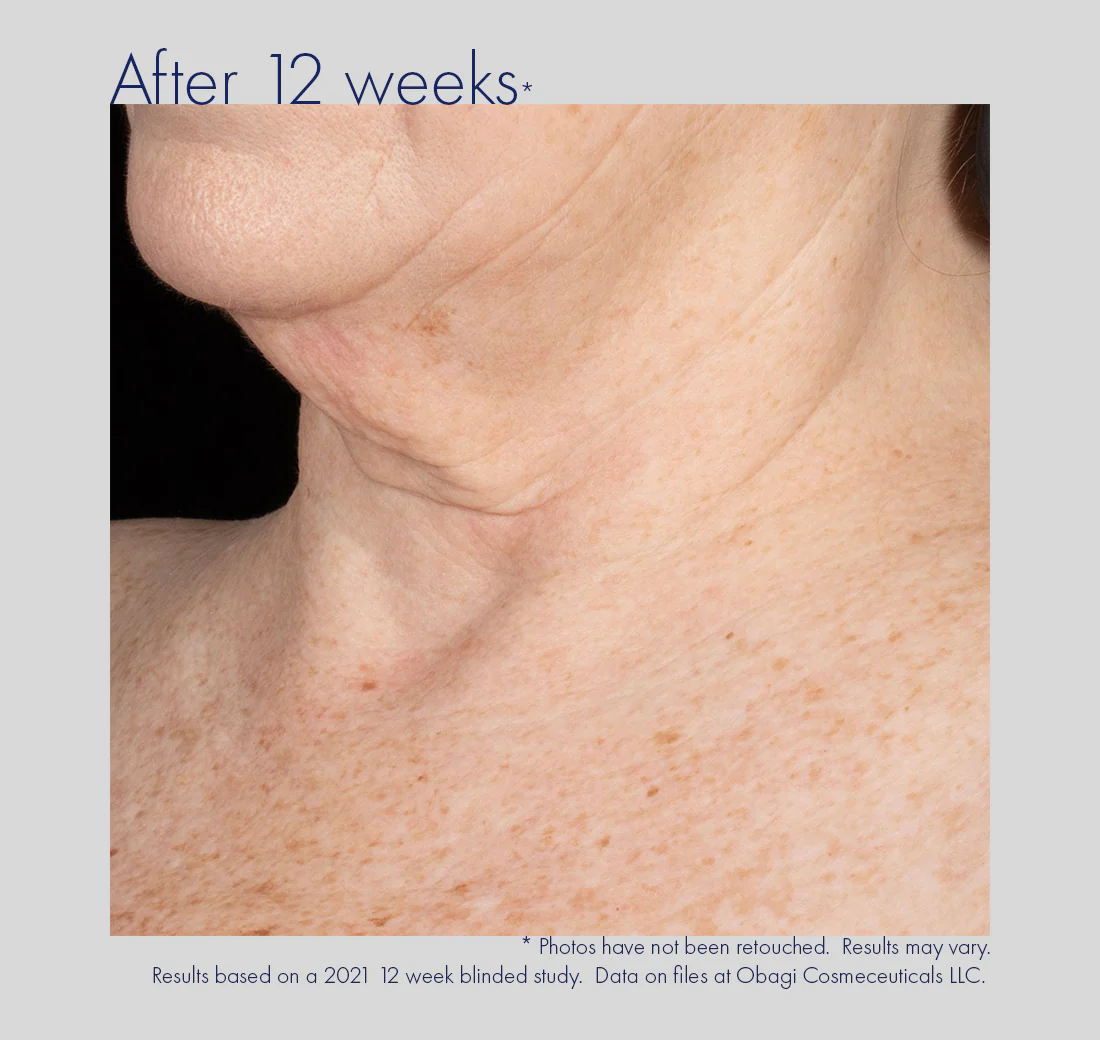 Obagi | ELASTIderm Neck and Décolleté Concentrate (60mls) - Image 4