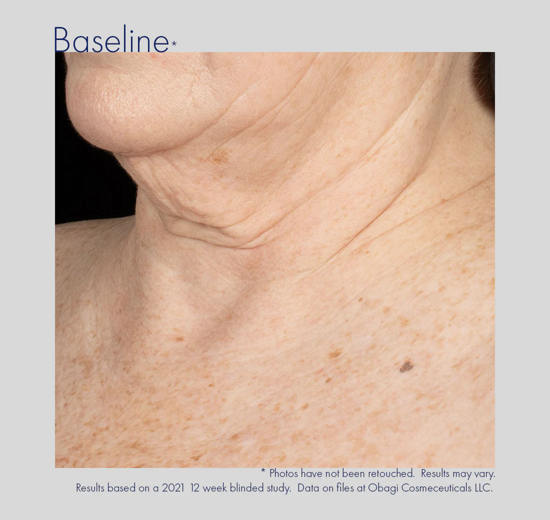 Obagi | ELASTIderm Neck and Décolleté Concentrate (60mls) - Image 5
