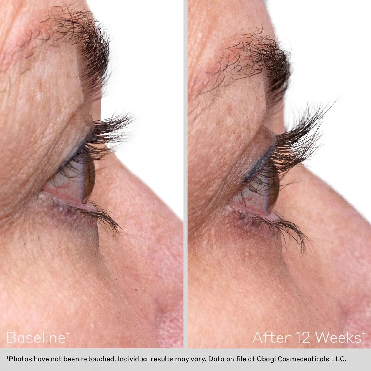 Obagi | Obagi Nu-Cil Eyelash Enhancing Serum (3ml) - Image 10
