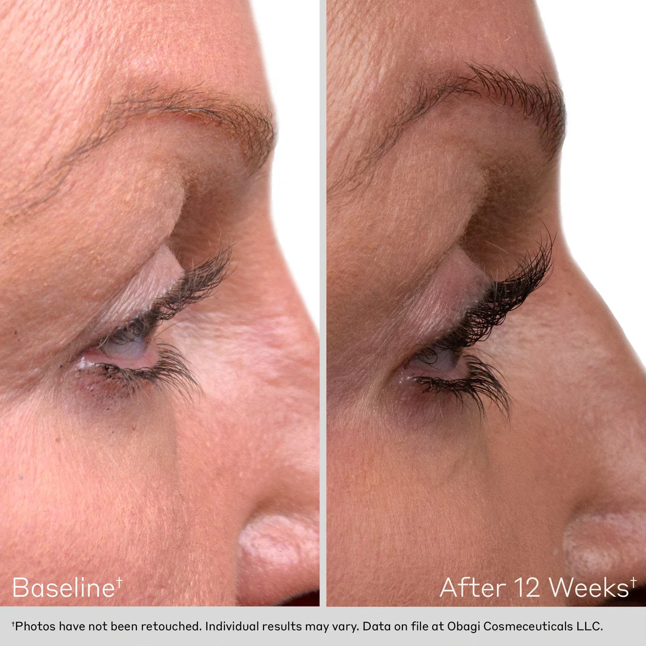 Obagi | Obagi Nu-Cil Eyelash Enhancing Serum (3ml) - Image 11