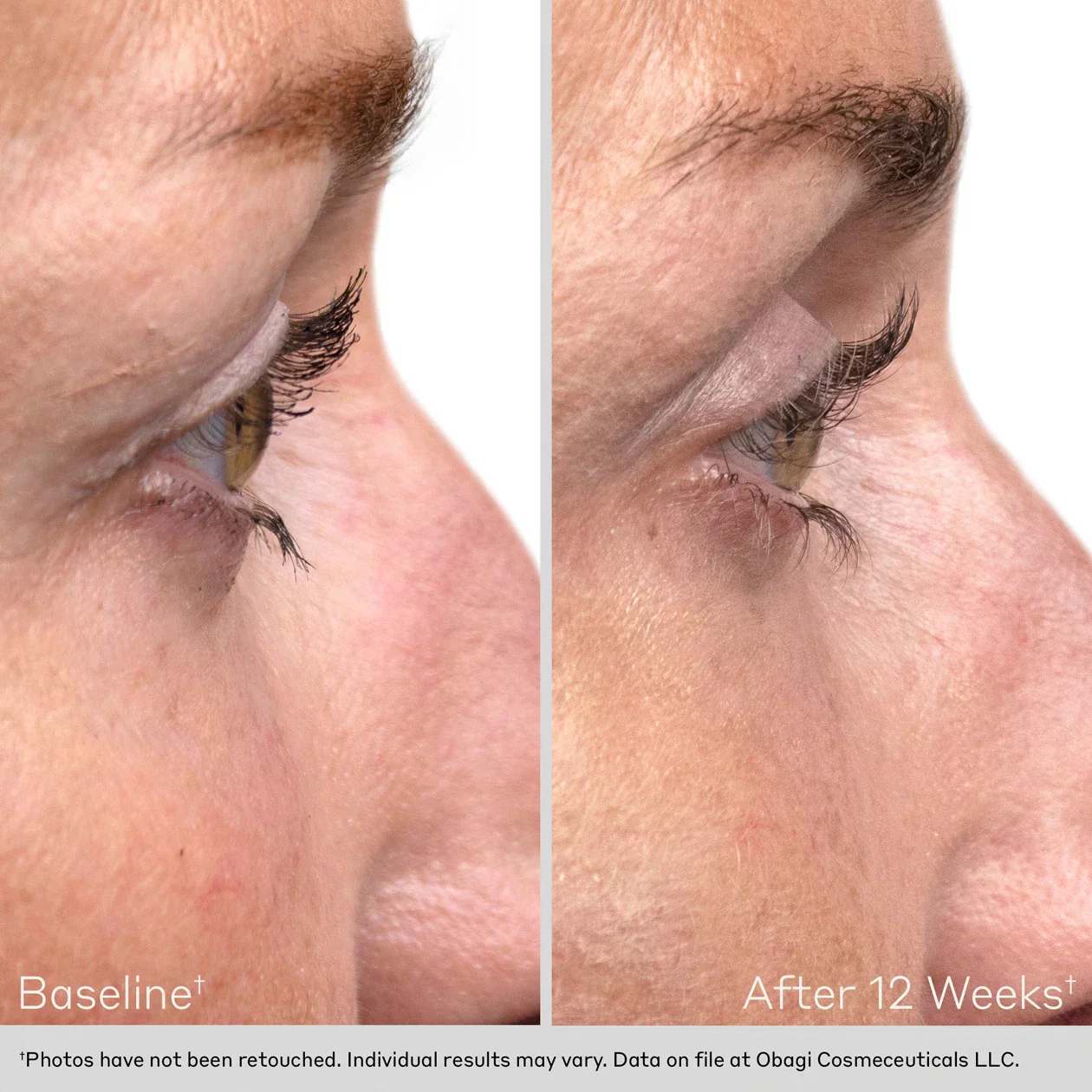 Obagi | Obagi Nu-Cil Eyelash Enhancing Serum (3ml) - Image 9