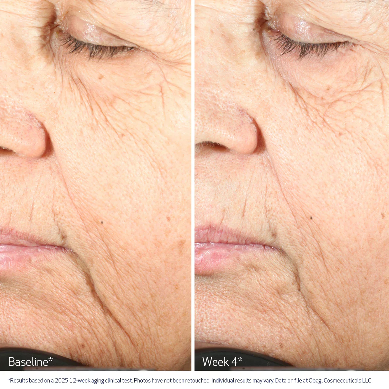 Obagi | NU-GEN Cellular Renewal Serum - Image 5