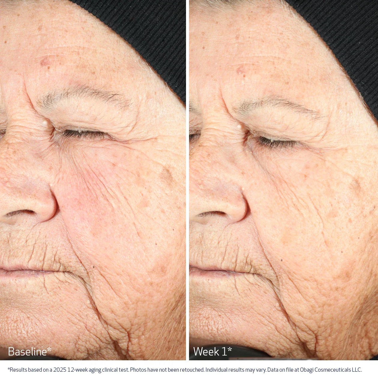 Obagi | NU-GEN Cellular Renewal Serum - Image 6
