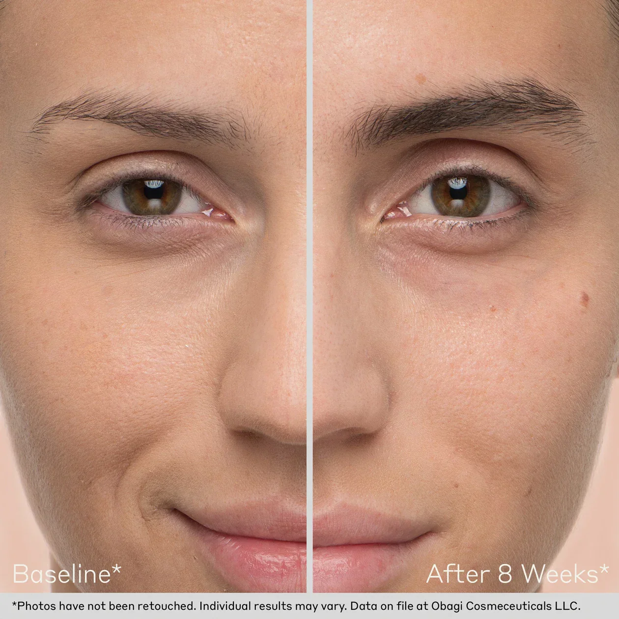 Obagi | Obagi Nu-Cil EyeBrow Boosting Serum (5ml) - Image 3