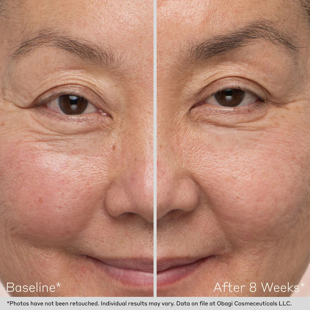 Obagi | Obagi Nu-Cil EyeBrow Boosting Serum (5ml) - Image 4