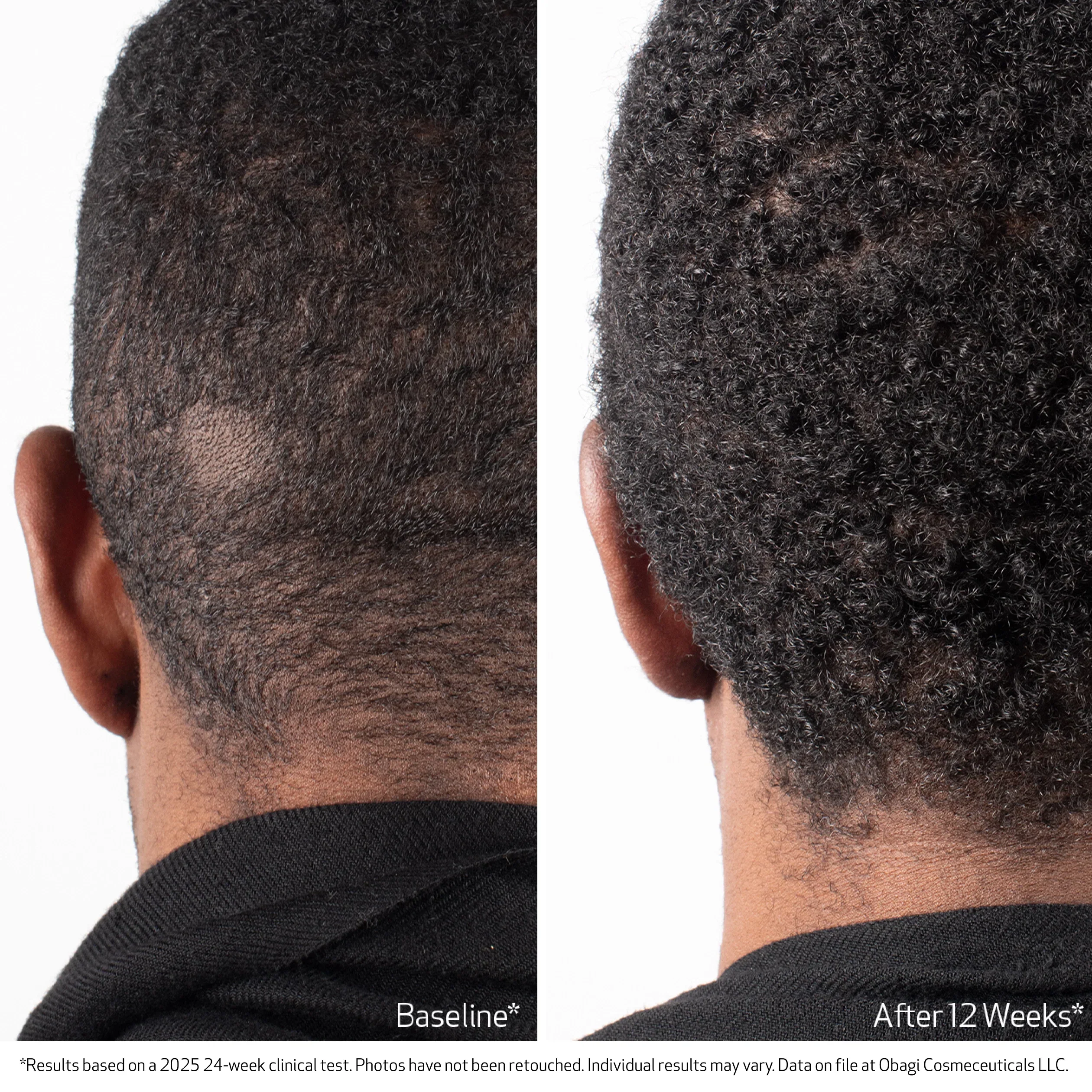 Obagi | Obagi Nu-Cil BioStim Scalp Serum (60ml) - Image 4