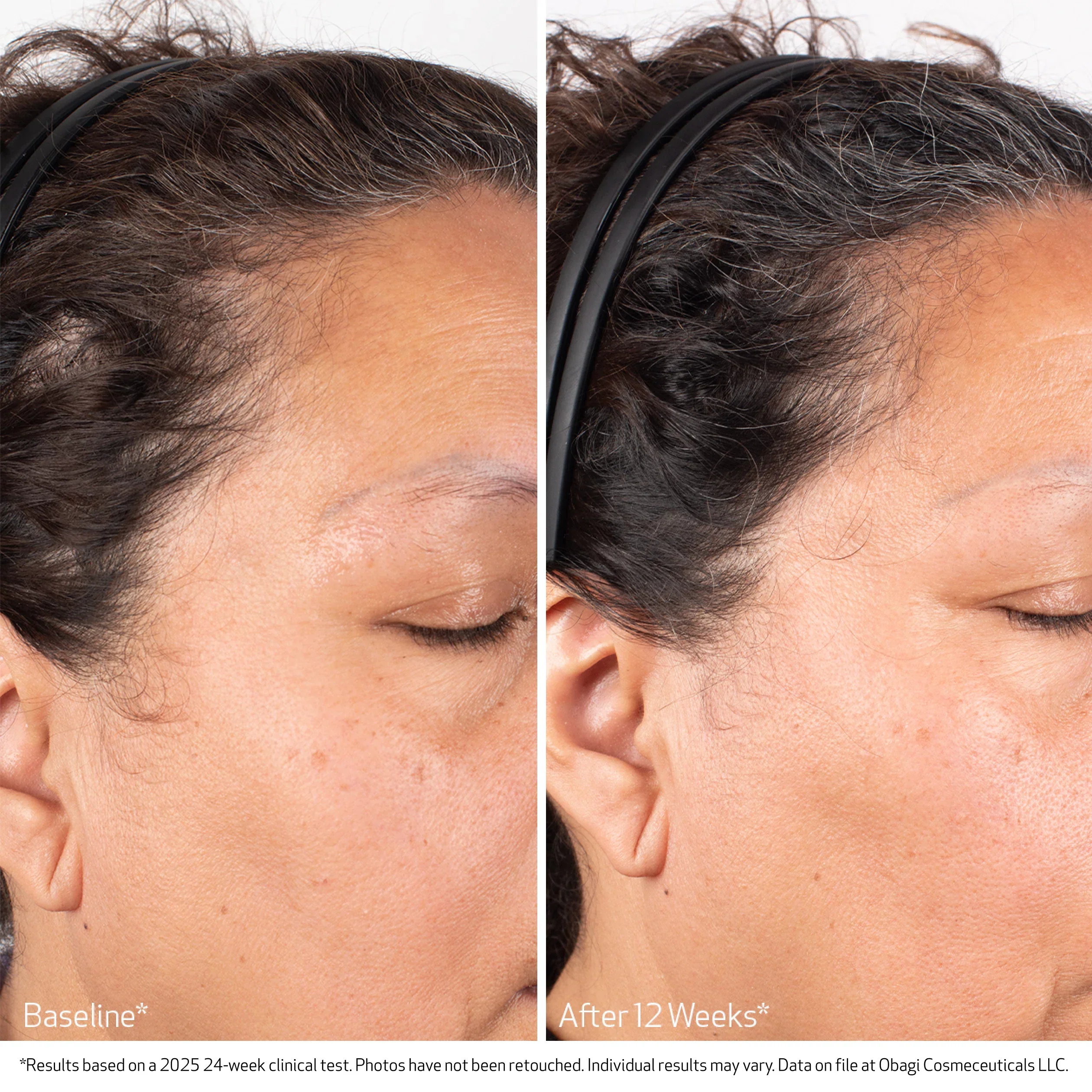 Obagi | Obagi Nu-Cil BioStim Scalp Serum (60ml) - Image 5