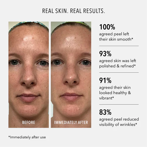 HydroPeptide | Polish & Plump Face Peel (2x 30ml) - Image 4